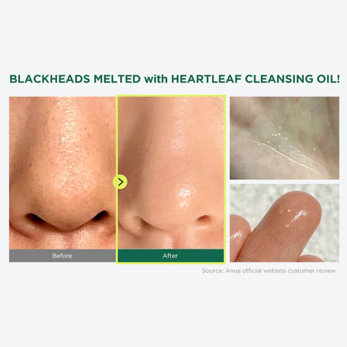 Buy Anua Heartleaf Pore Control Cleansing Oil in Pakistan