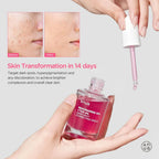 Buy Anua Niacinamide 10% + TXA 4% Dark Spot Correcting Serum in Pakistan