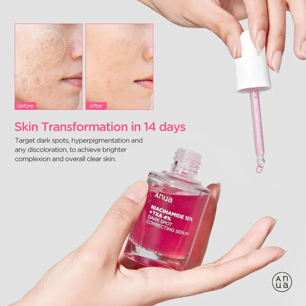 Buy Anua Niacinamide 10% + TXA 4% Dark Spot Correcting Serum in Pakistan