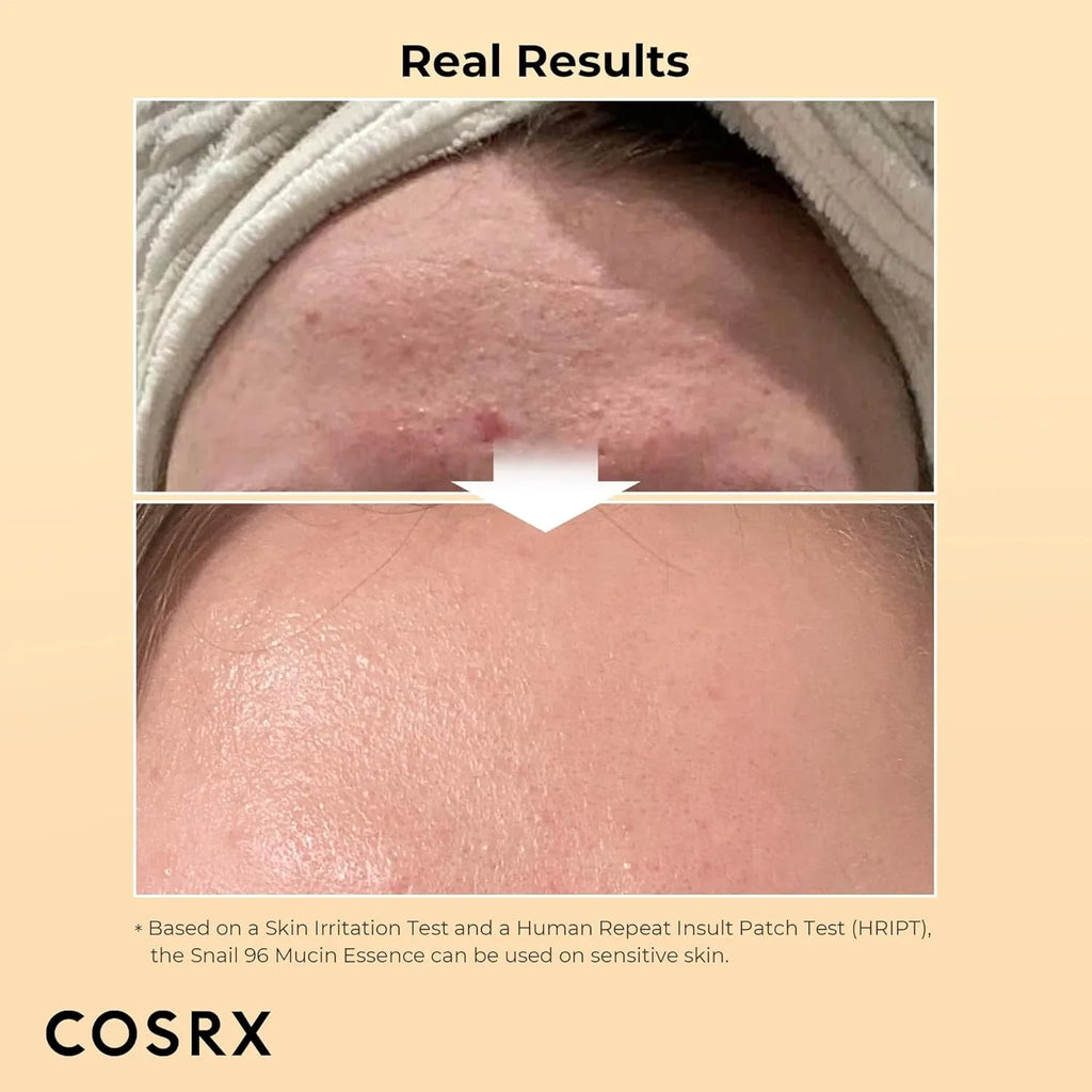 Buy Cosrx - Advanced Snail 96 Mucin Power Essence in Pakistan