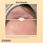 Buy Cosrx - Advanced Snail 96 Mucin Power Essence in Pakistan