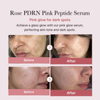 Buy Medicube PDRN Pink Peptide Serum - 30ml in Pakistan