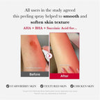 Buy MEDICUBE - Red Acne Body Peeling Shot - 110G in Pakistan