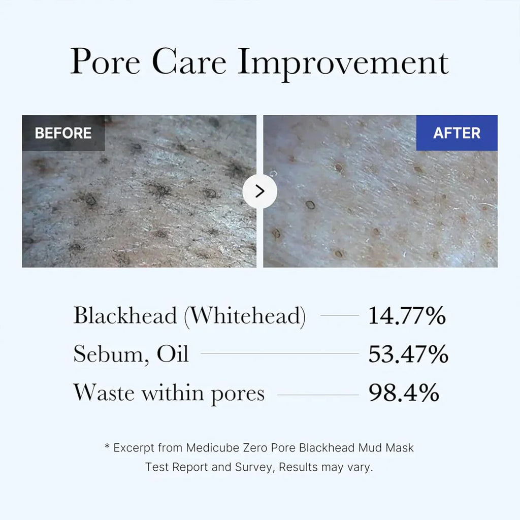 Buy MEDICUBE - Zero Pore Blackhead Mud Mask - 100G in Pakistan
